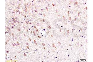 Formalin-fixed and paraffin embedded: rat brain tissue labeled with Anti-NK-2R Polyclonal Antibody (ABIN725315), Unconjugated at 1:200 followed by conjugation to the secondary antibody and DAB staining (TACR2 anticorps  (AA 223-300))