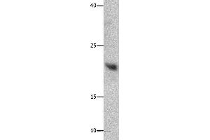 Western blot analysis of Mouse liver tissue, using GFER Polyclonal Antibody at dilution of 1:750 (GFER anticorps)