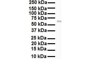 WB Suggested Anti-RIPK3 antibody Titration: 1 ug/mL Sample Type: Human Jurkat