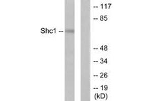 Western blot analysis of extracts from HeLa cells, treated with Calyculin A 50nM 15', using Shc (Ab-427) Antibody. (SHC1 anticorps  (AA 393-442))