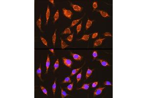 Immunofluorescence analysis of L929 cells using NDUF Rabbit pAb (ABIN6132401, ABIN6144467, ABIN6144468 and ABIN6215694) at dilution of 1:100 (40x lens).