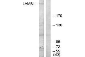 Western blot analysis of extracts from HepG2 cells, using LAMB1 antibody. (Laminin beta 1 anticorps  (C-Term))