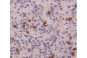 IHC-P analysis of Human Tissue, with DAB staining. (CLOCK anticorps  (AA 34-379))