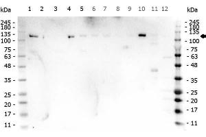 WB of Rabbit anti-PARP1 multi lysate Western Blot of Rabbit anti-PARP1 antibody.