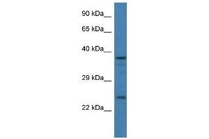 Western Blot showing GAP43 antibody used at a concentration of 1 ug/ml against 293T Cell Lysate (GAP43 anticorps  (C-Term))