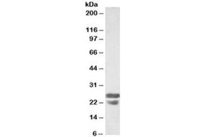 Western blot testing of mouse spleen lysates with ASC antibody at 0. (PYCARD anticorps)