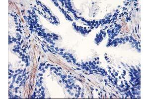 Immunohistochemical staining of paraffin-embedded Human prostate tissue using anti-PPARA mouse monoclonal antibody. (PPARA anticorps  (AA 145-420))