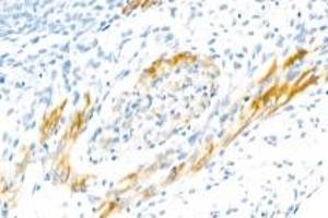 Immunohistochemistry analysis of paraffin-embedded rat embryo using CNTN5 (ABIN7073575) at dilution of 1: 2000 (Contactin 5 anticorps)