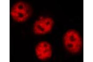 ABIN6267622 staining A431 by IF/ICC.