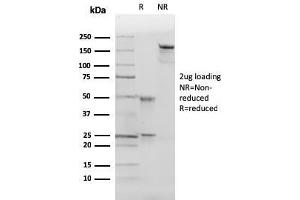 anti-Cyclin-Dependent Kinase Inhibitor 1B (p27, Kip1) (CDKN1B) antibody