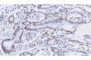 Immunohistochemistry (IHC) image for anti-Kruppel-Like Factor 4 (Gut) (KLF4) (AA 1-170), (N-Term) antibody (ABIN336104)