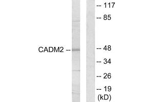 Western Blotting (WB) image for anti-Cell Adhesion Molecule 2 (CADM2) (Internal Region) antibody (ABIN1850234) (CADM2 anticorps  (Internal Region))