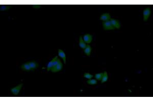 Detection of GSTp in Human MCF7 cell using Polyclonal Antibody to Glutathione S Transferase Pi (GSTp)