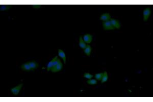 Detection of GSTp in Human MCF7 cell using Polyclonal Antibody to Glutathione S Transferase Pi (GSTp) (GSTP1 anticorps  (AA 1-210))