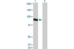 Western Blot analysis of TOP3B expression in transfected 293T cell line by TOP3B monoclonal antibody (M06), clone 2G2. (TOP3B anticorps  (AA 1-862))