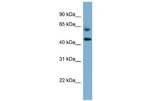 RMND1 antibody used at 1 ug/ml to detect target protein. (RMND1 anticorps)
