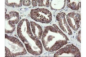 anti-Methionyl Aminopeptidase 2 (METAP2) (AA 2-212) antibody