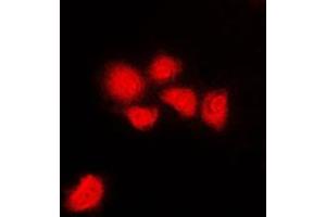 Immunofluorescent analysis of CDK1/2/3 (pT14) staining in HeLa cells. (CDK1/2/3 (N-Term), (pSer14) anticorps)