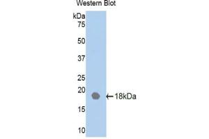 Western blot analysis of the recombinant protein. (IL18RAP anticorps  (AA 117-240))