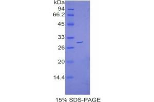 SDS-PAGE analysis of Mouse Catenin beta 1 Protein.