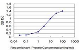 Detection limit for recombinant GST tagged KIAA2002 is approximately 0.