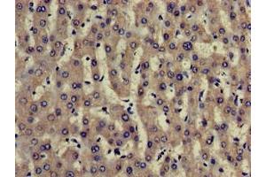 Immunohistochemistry of paraffin-embedded human liver tissue using ABIN7173904 at dilution of 1:100 (TRADD anticorps  (AA 1-312))