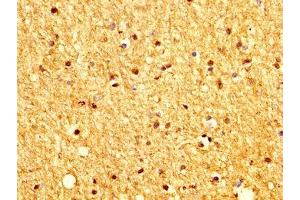 IHC image of ABIN7165907 diluted at 1:200 and staining in paraffin-embedded human brain tissue performed on a Leica BondTM system. (Patched 2 anticorps  (AA 793-951))