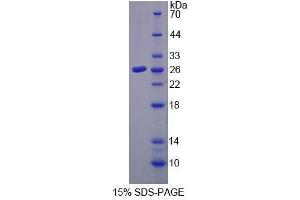 SDS-PAGE of Protein Standard from the Kit (Highly purified E.