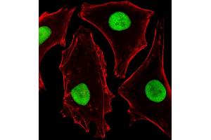 Fluorescent image of Hela cells stained with SUMO2 Antibody (C-term) B. (SUMO2 anticorps)