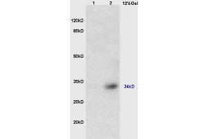 Lane 1: mouse brain lysates Lane 2: mouse heart lysates probed with Anti TUSC3 Polyclonal Antibody, Unconjugated (ABIN762656) at 1:200 in 4 °C. (TUSC3 anticorps  (AA 201-300))