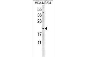 Western blot analysis of NEU1 Antibody (Center) (ABIN653650 and ABIN2842991) in MDA-M cell line lysates (35 μg/lane). (NEU1 anticorps  (AA 11-40))