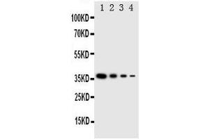 Lane 4: Recombinant Human LAT2 Protein 1.