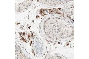 Immunohistochemical staining of human testis with GAPT polyclonal antibody  shows strong granular cytoplasmic positivity in leydig cells.