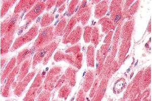 ABIN5539612 (5µg/ml) staining of paraffin embedded Human Heart.