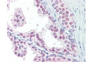Anti-UBC / Ubiquitin C antibody IHC of human prostate.
