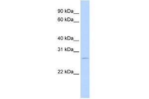RBM38 antibody used at 0. (RBM38 anticorps  (N-Term))