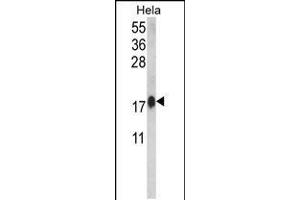 Western blot analysis of CALM1 Antibody in Hela cell line lysates (35ug/lane)(2ug/ml) (Calmodulin 1 anticorps  (C-Term))