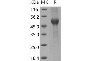 Western Blotting (WB) image for Activin A Receptor Type II-Like 1 (ACVRL1) (Active) protein (His tag,Fc Tag) (ABIN7194120)