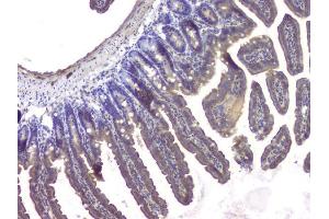 IHC analysis of HDAC5 using anti-HDAC5 antibody (ABIN6719321). (HDAC5 anticorps  (AA 102-197))