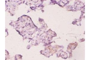 Immunohistochemistry of paraffin-embedded human placenta tissue using ABIN7174460 at dilution of 1:20 (UBE2K anticorps  (AA 2-200))