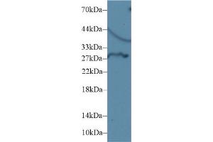Detection of DIO3 in Rat Liver lysate using Polyclonal Antibody to Deiodinase, Iodothyronine, Type III (DIO3) (DIO3 anticorps  (AA 37-169))