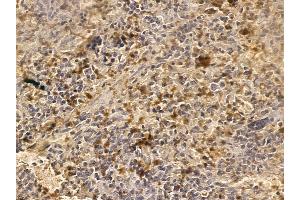 RIMS2 Mouse Monoclonal Antibody at 1/100 staining rat spleen tissue by IHC-P. (RIMS2 anticorps)