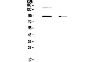 Western blot analysis of PDE4D using anti-PDE4D antibody .