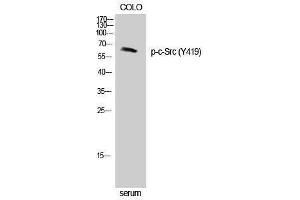 Western Blotting (WB) image for anti-Proto-oncogene tyrosine-protein kinase Src (Src) (pTyr419) antibody (ABIN3179423) (Src anticorps  (pTyr419))
