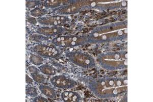 Immunohistochemical staining of human duodenum with EDARADD polyclonal antibody  shows distinct positivity in glandular cells at 1:50-1:200 dilution. (EDARADD anticorps)