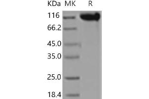 Western Blotting (WB) image for Selectin E (SELE) (Active) protein (Fc Tag) (ABIN7197868) (Selectin E/CD62e Protein (Fc Tag))
