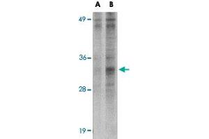 Western blot analysis of METTL7B in Jurkat cell lysate with METTL7B polyclonal antibody  at (A) 2 and (B) 4 ug/mL . (METTL7B anticorps  (N-Term))