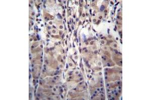 Immunohistochemistry analysis in formalin fixed and paraffin embedded human stomach tissue reacted with MDM1 Antibody (C-term) followed which was peroxidase conjugated to the secondary antibody and followed by DAB staining. (MDM1 anticorps  (C-Term))