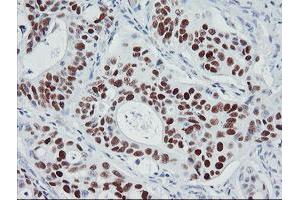 Image no. 9 for anti-Tumor Protein P53 (TP53) antibody (ABIN1499967) (p53 anticorps)