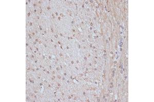 Immunohistochemistry of paraffin-embedded rat brain using SNW1 antibody (ABIN7270386) at dilution of 1:100 (40x lens).